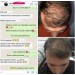 Dökülme Önleyici Saç Bakım Yağı Saç Çıkarıcı  Kök Uyarıcı Saçları Besleyen Uzatan Formül 150 Ml Argan Yağlı Saç Kopleksi